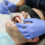 dental implant pain