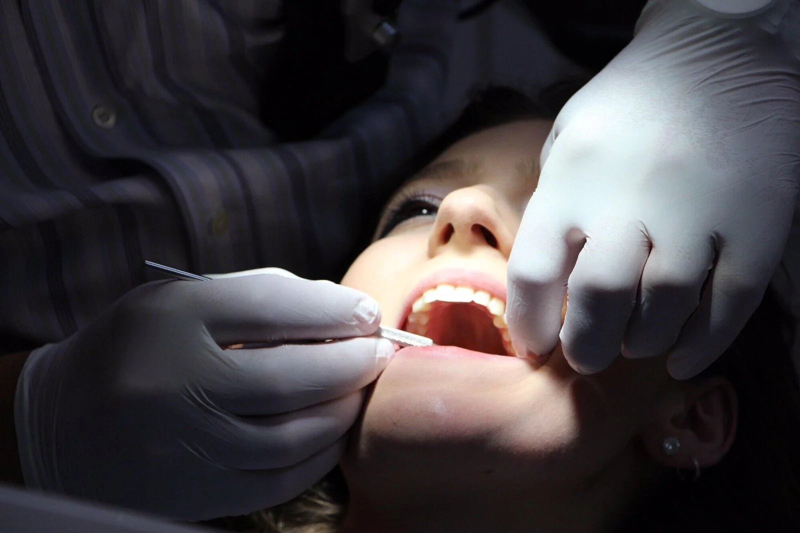 crowns on front teeth